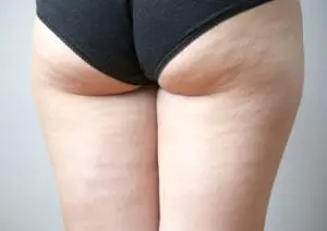 Female thighs