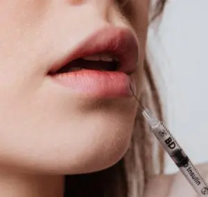 Lip Fillers Watford