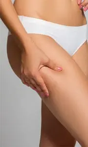 cellulite treatment Hertfordshire