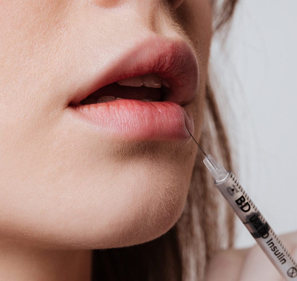 Lip Enhancement Image
